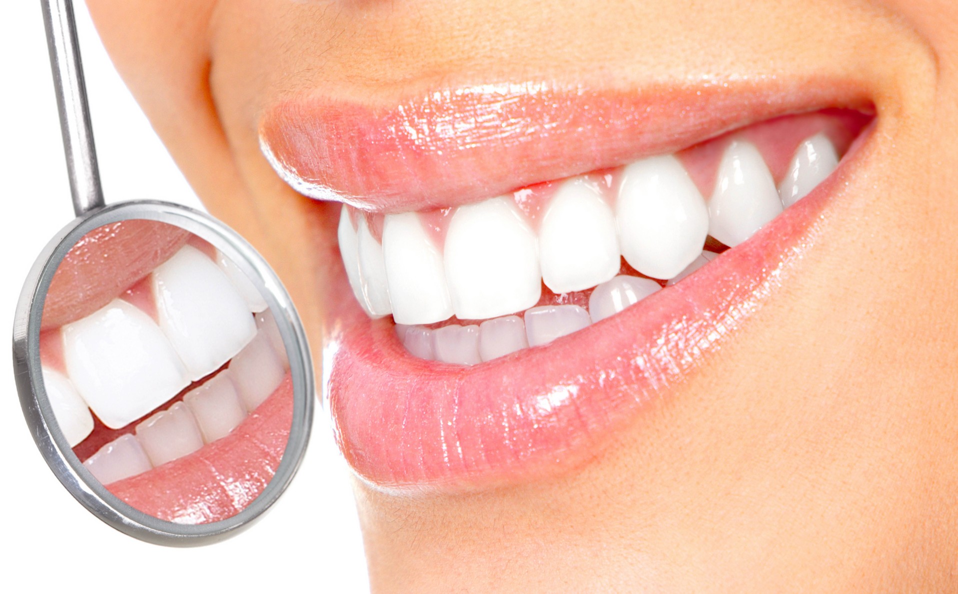 whitesmile